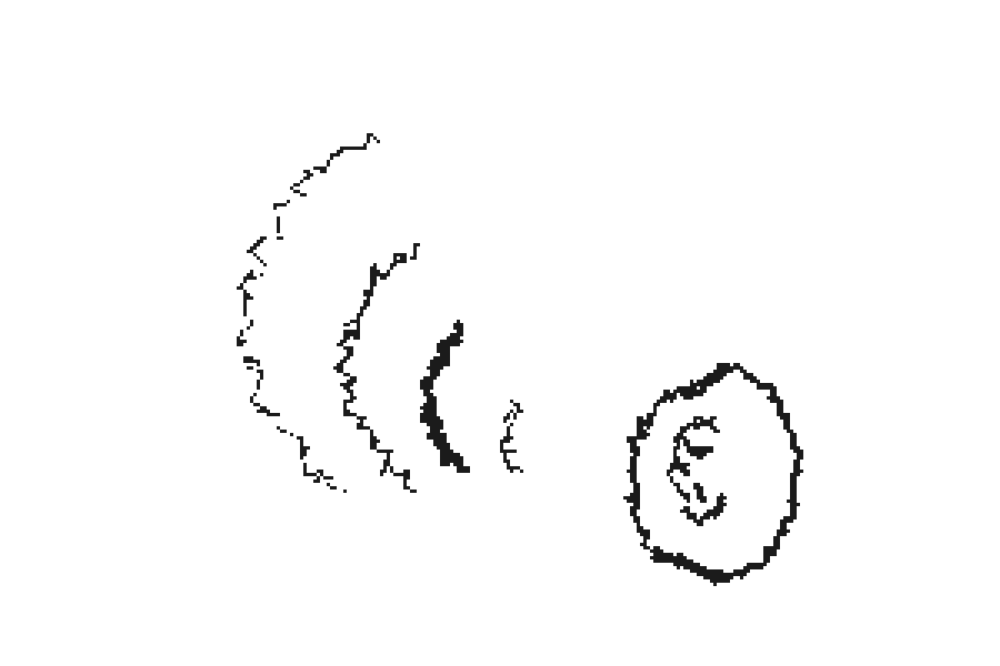 A lopsided ear with sound-wave arcs of uneven sizes